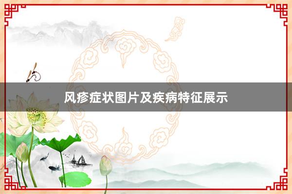 风疹症状图片及疾病特征展示